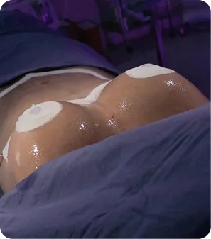 Mastopexia en Colombia con el Dr. Alexander Luján
