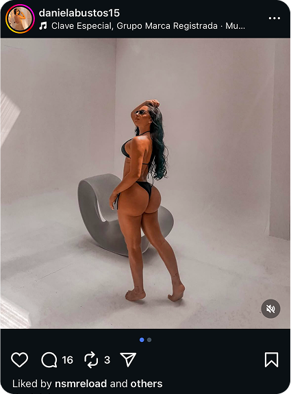 dr alexander lujan cirujia Transferencia de grasa a gluteos o BBL