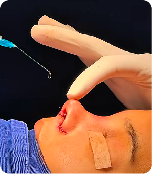 rinoplastia en medellin con el dr alexander lujan